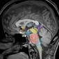 Цистерны головного мозга Сагиттальная анатомия и цистерны головного мозга