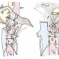 Топография лимфатических узлов брюшной полости Рис. 4