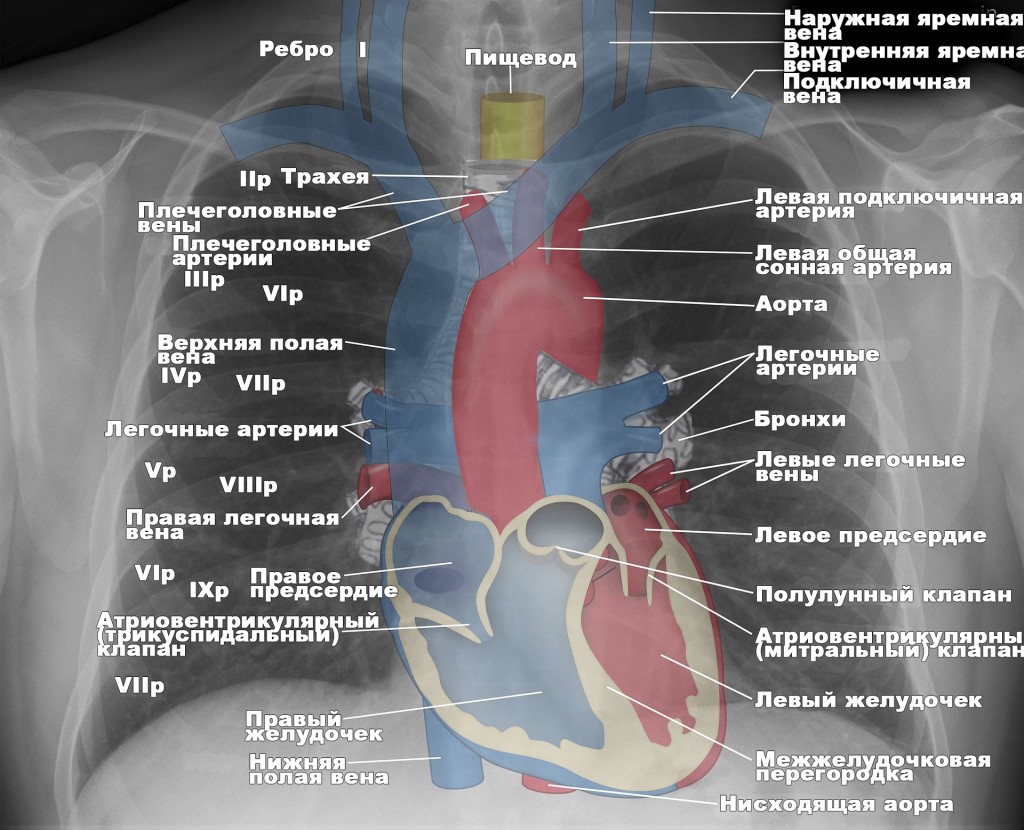 Рентгенография органов грудной клетки - Системный подход