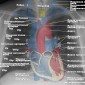 Рентгенография органов грудной клетки - Системный подход Рентгенография грудной клетки в прямой проекции