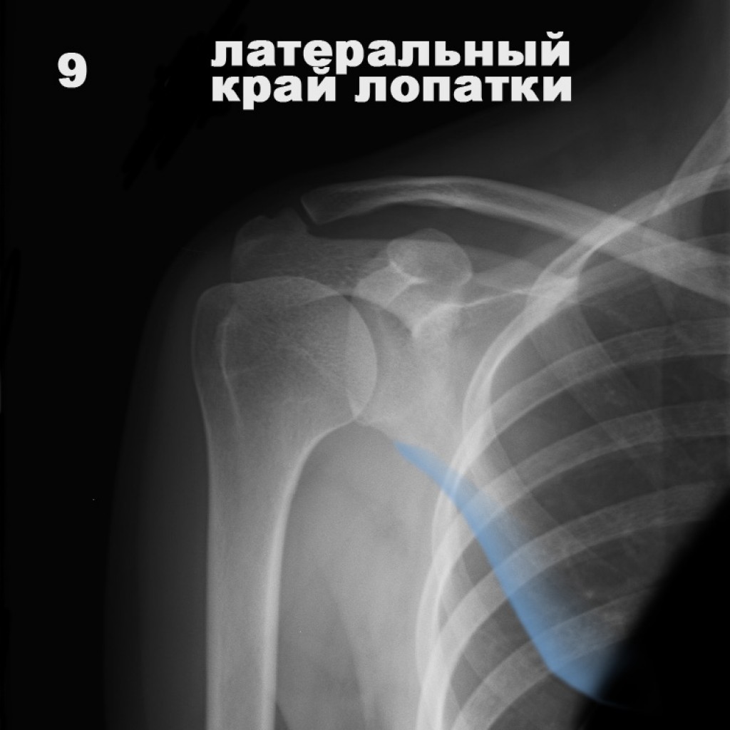 Рентгенография плечевого сустава (нормальная анатомия)