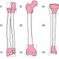 Классификация переломов трубчатых костей Мюллера АО (Ассоциации Осетосинтеза) Рис 2 Обозначение анатомической локализации