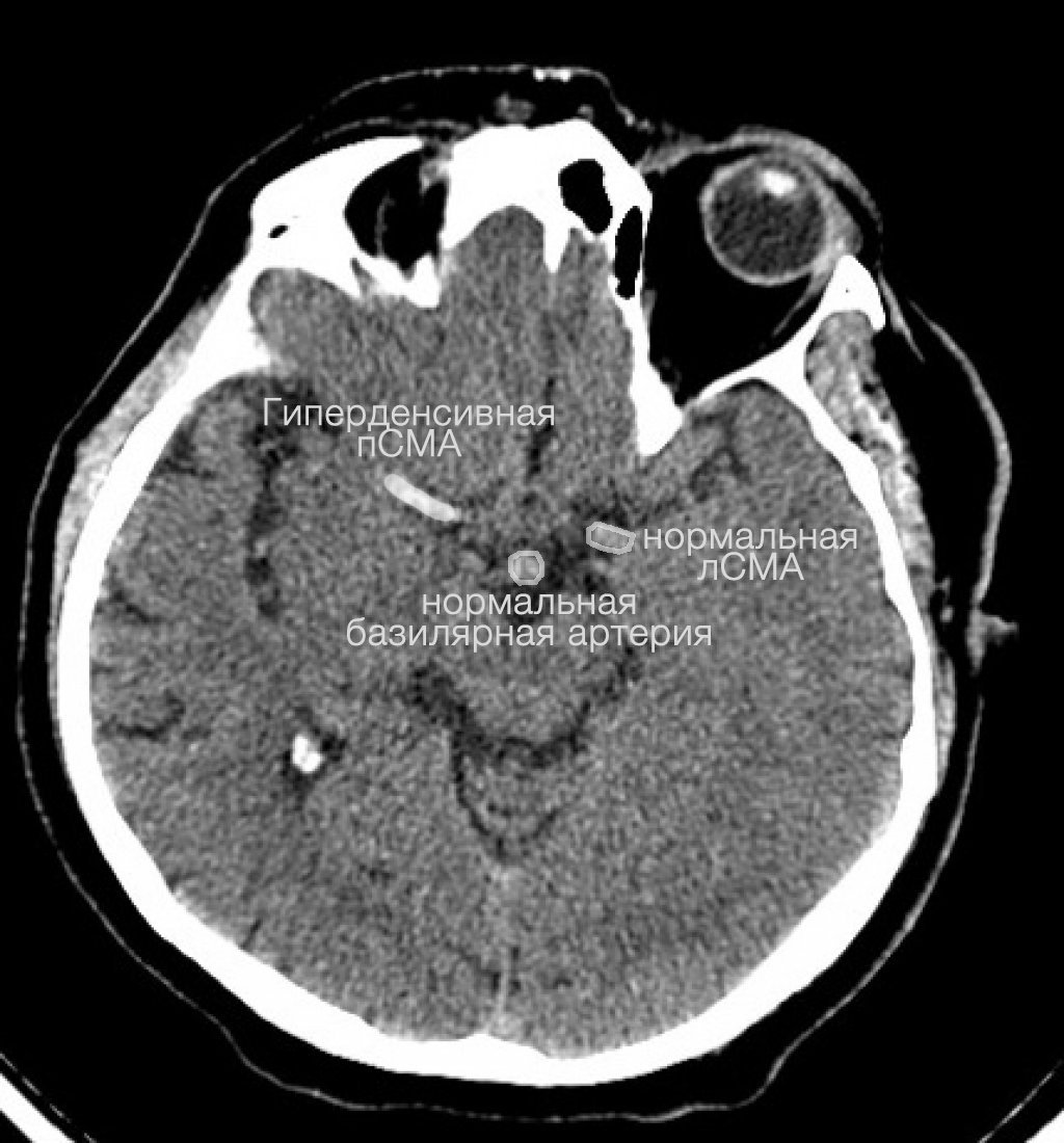 КТ головного мозга (системный подход)