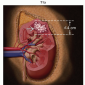 Почечно-клеточный рак (стадирование TNM) T1