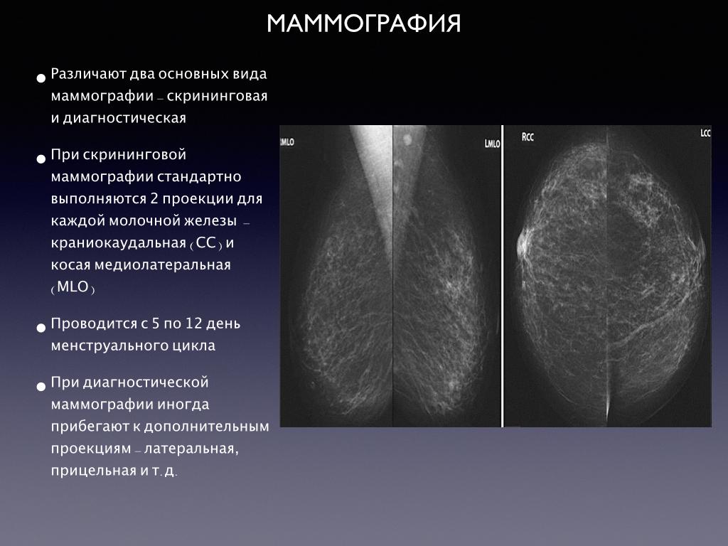 Маммография день цикла. Маммография показания. Показания для проведения маммографии. Первый день цикла маммография. Маммография периодичность